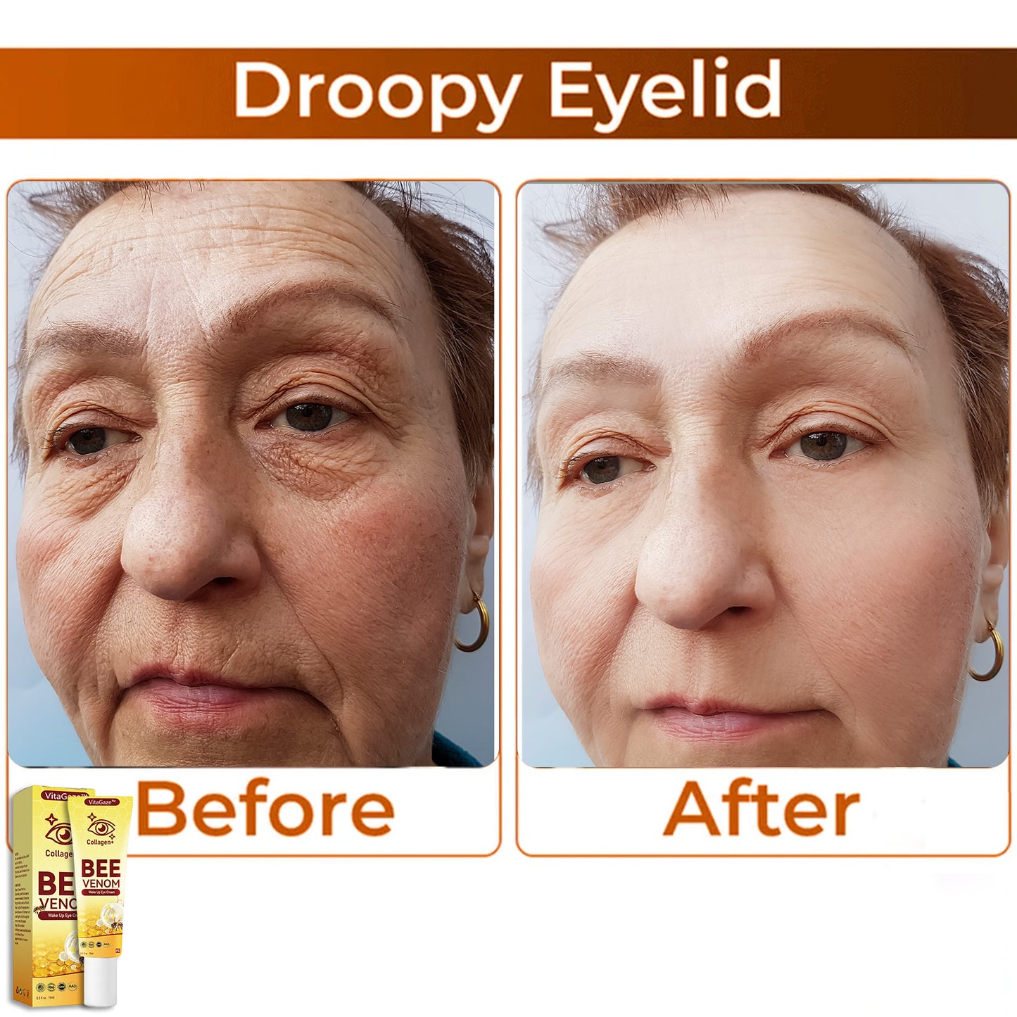 🐝VitaGaze™ Collagen+ Bee Venom Wake Up Eye Cream US Patented Exclusive Dermatologist Recommended