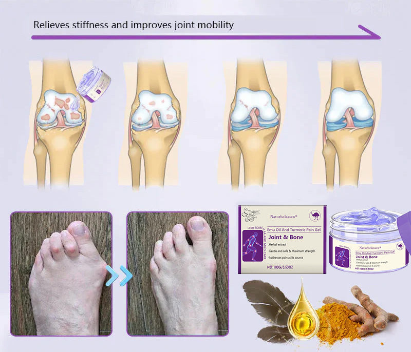 šNaturbelassenĀ® Emu Oil And Turmeric Pain GelšØāāļø FDA Approved š„