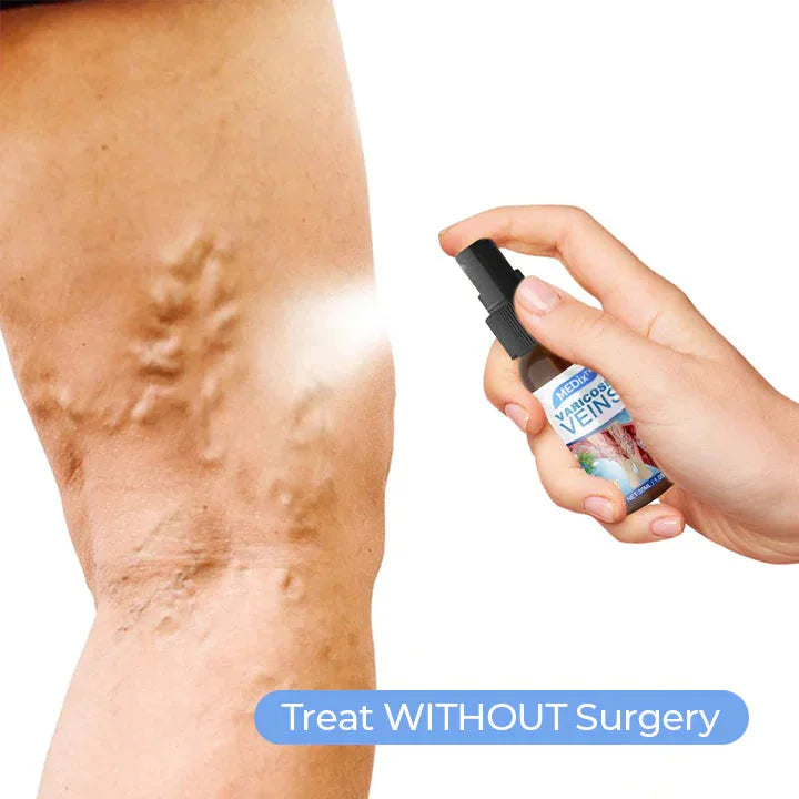 ✨Today's Limited Time Specials ✨MEDix™ Varicose Veins Spray