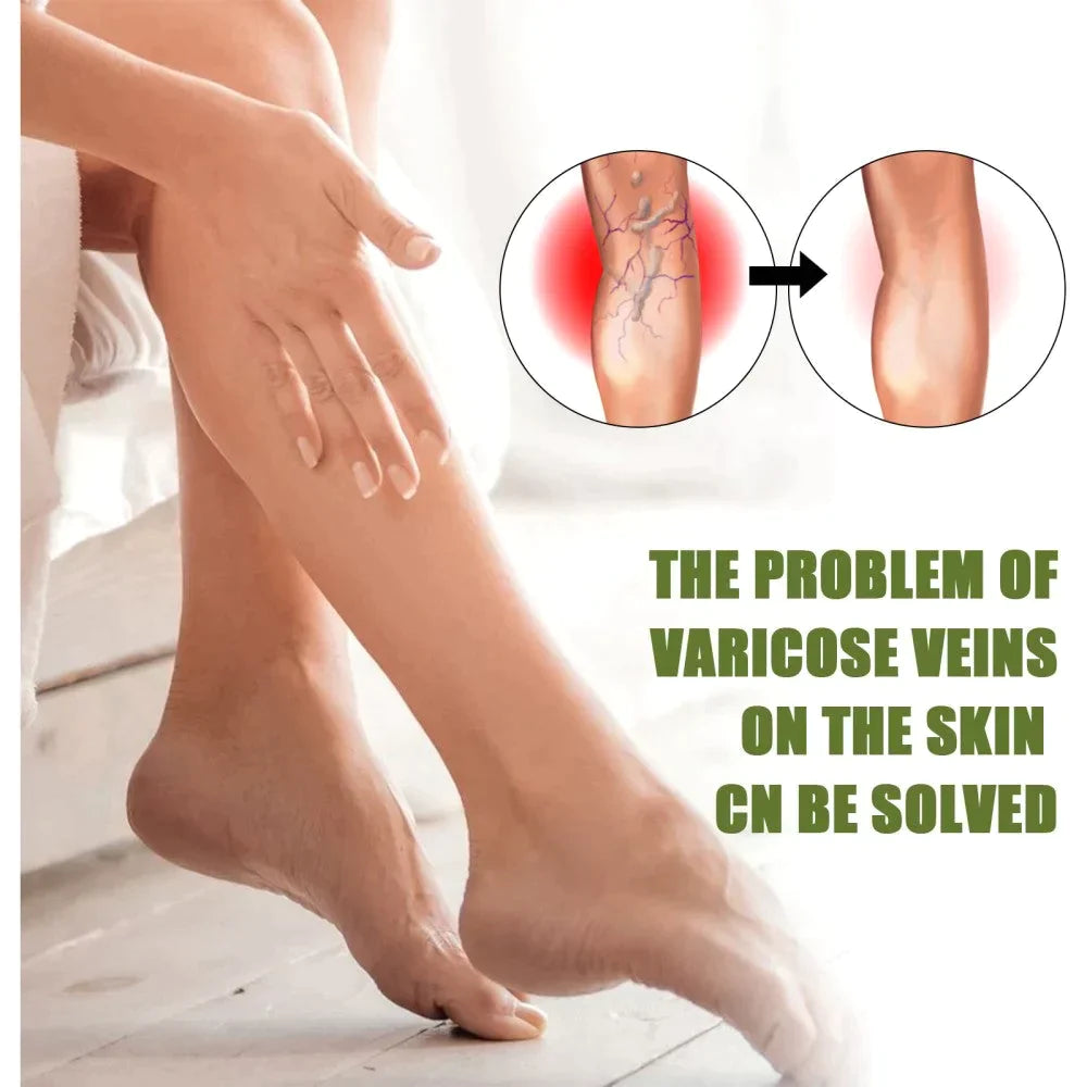 ✨Today's Limited Time Specials ✨MEDix™ Varicose Veins Spray