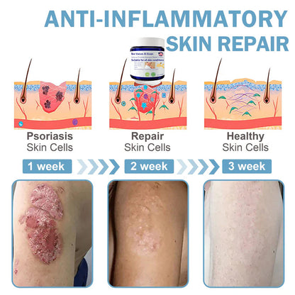🌞Bee Venom & Ocean Natural Eczema Psoriasis Relief Cream (For all skin conditions)